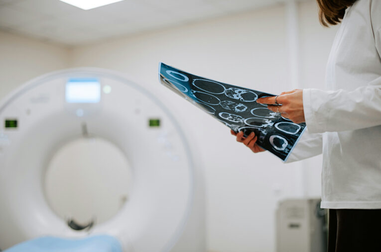 Computertomografie mit Befundkontrolle